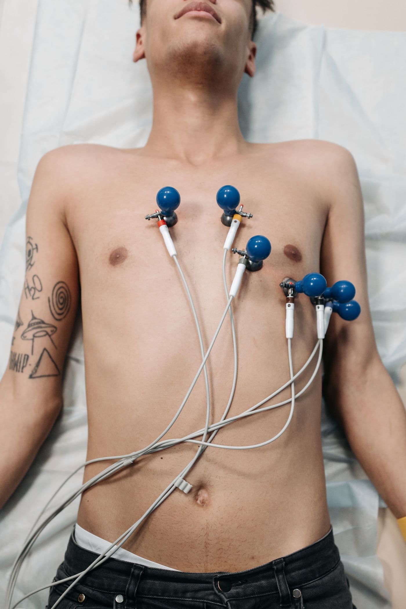Eletrocardiografia