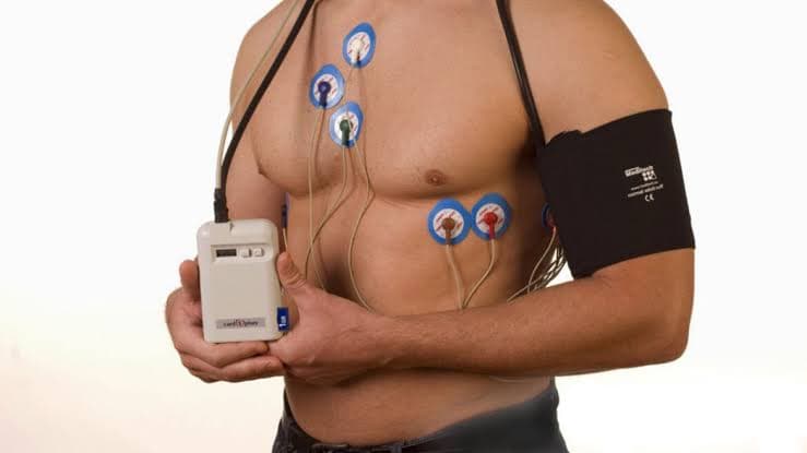 Holter 24h